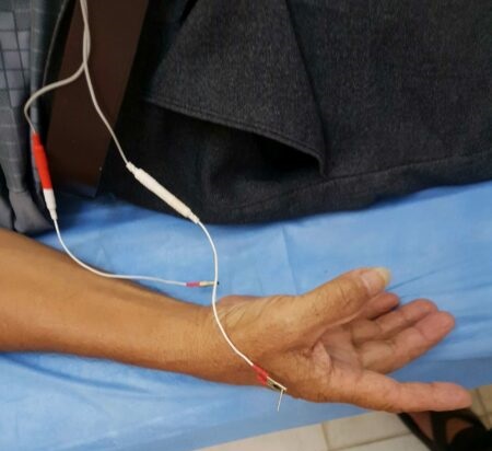 formation acupuncture