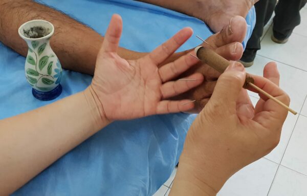formation acupuncture bretagne